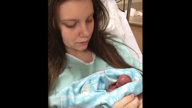 WATCH Parents release incredible video of living 18week miscarried